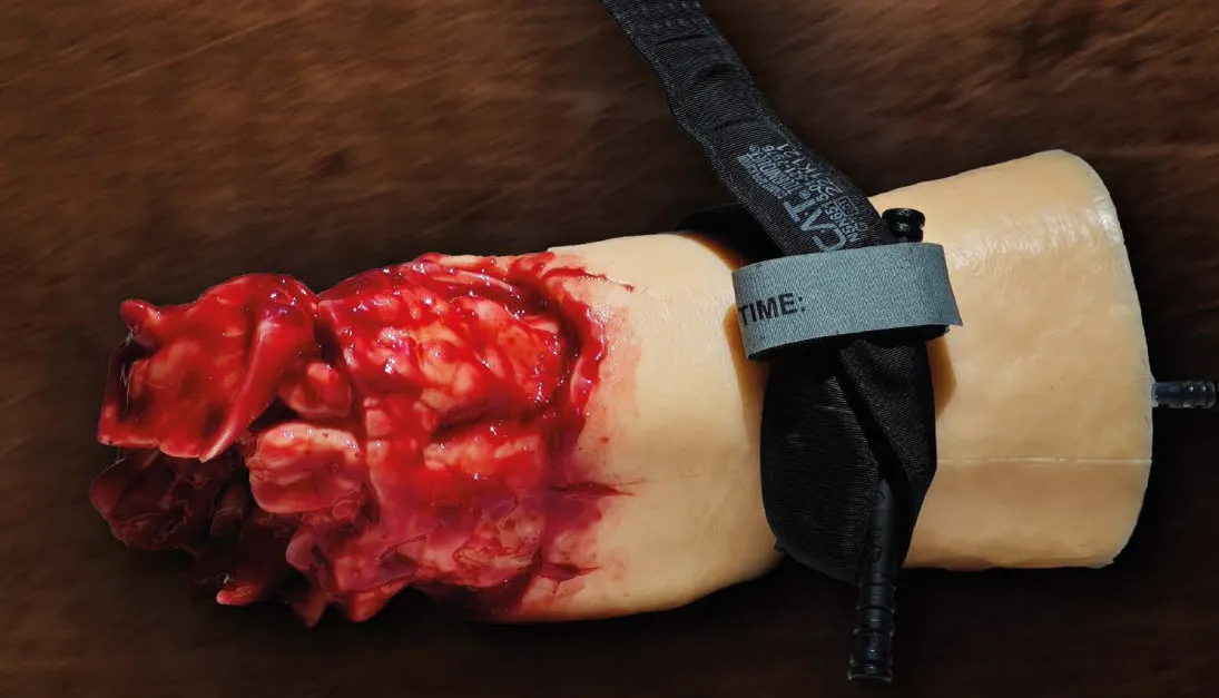 Trauma Leg