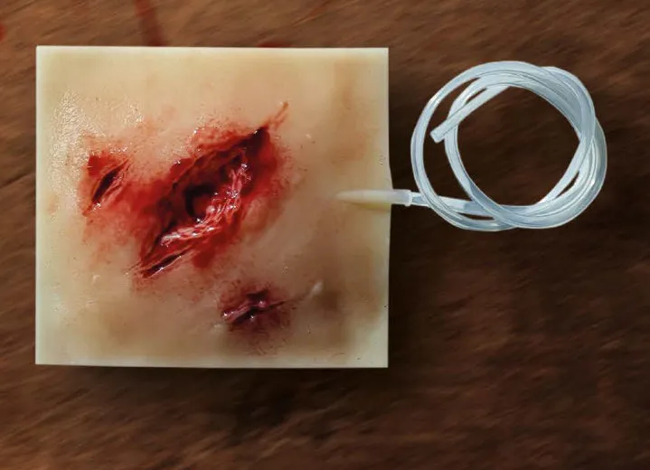 Wound Pads - komplet 4 szt.